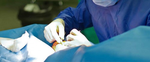Imagem da notícia: Portugueses desenvolvem cirurgia às hérnias