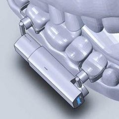 Imagem da notícia: Tratar as deformidades faciais com um “micro-robot”