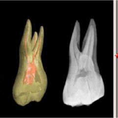 Imagem da notícia: 3D Tooth Atlas &eacute; atualizado