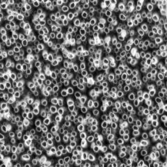 Imagem da notícia: Sucesso de implantes apoiado em tecnologia nano