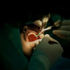 Imagem da notícia: Austr&aacute;lia quer implementar medidas anti-VIH