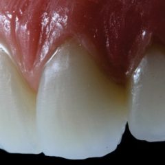Imagem da notícia: Curso de Est&eacute;tica Funcional para t&eacute;cnicos de pr&oacute;tese dent&aacute;ria