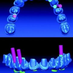 Imagem da notícia: “Sistema BIO CAD/CAM”