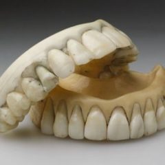 Imagem da notícia: Pr&oacute;teses cer&acirc;micas: um pouco de hist&oacute;ria!