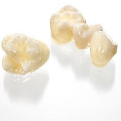 Imagem da notícia: Restaura&ccedil;&otilde;es de &oacute;xido de zirc&oacute;nio com Wieland Zenostar