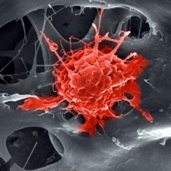 Imagem da notícia: Novo implante promove a regenera&ccedil;&atilde;o &oacute;ssea