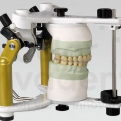 Imagem da notícia: Articulador idealizado para restaura&ccedil;&otilde;es complexas