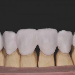 Imagem da notícia: “Desenhar um sorriso com Zirconia Prettau”