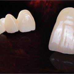 Imagem da notícia: Novas soluções em zirconia para CAD/CAM