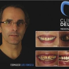 Imagem da notícia: Diagn&oacute;stico e Planeamento para Reabilita&ccedil;&atilde;o no Setor Anterior