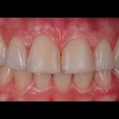 Imagem da notícia: Recuperar um sorriso com solu&ccedil;&otilde;es Handmade