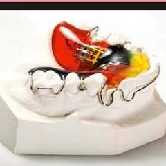 Imagem da notícia: Pós-Graduação em Ortodontia Laboratorial