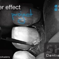 Imagem da notícia: Shape Dentistry Academy apresenta “The veneer effect project”