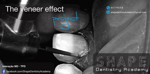 Imagem da notícia: Shape Dentistry Academy apresenta “The veneer effect project”