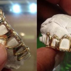 Imagem da notícia: Branqueamento dent&aacute;rio e inova&ccedil;&atilde;o acabam com ouro