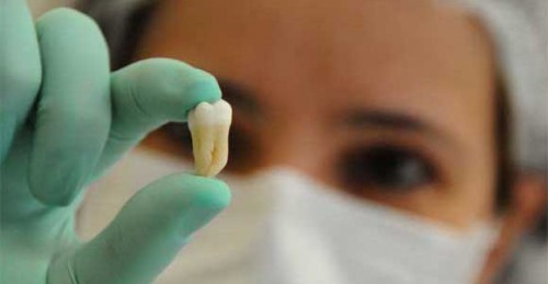 Imagem da notícia: Estudante faz réplica dentária mais pequena do mundo