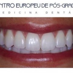Imagem da notícia: Curso de Pr&oacute;tese e Oclus&atilde;o
