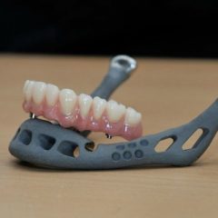 Imagem da notícia: Eis o primeiro transplante de mandíbula criado em impressão 3D