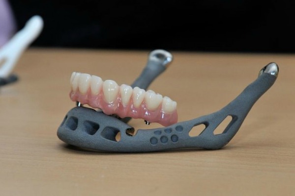 Imagem da notícia: Eis o primeiro transplante de mandíbula criado em impressão 3D