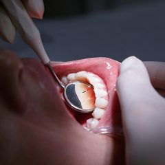 Imagem da notícia: Cancro oral é o sexto mais comum em Portugal