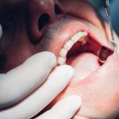 Imagem da notícia: Número de consultas caiu em 70% nas clínicas dentárias