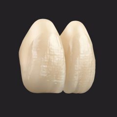 Imagem da notícia: VITA VIONIC VIGO: beleza e inteligência para próteses digitais