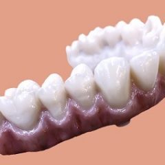 Imagem da notícia: Nobel e DOCERAM Medical Ceramics anunciam parceria