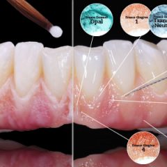 Imagem da notícia: Zirkonzahn apresenta Fresco Ceramics