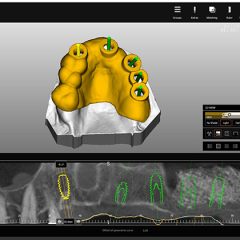 Imagem da notícia: Zirkonzahn apresenta Implant-Planner