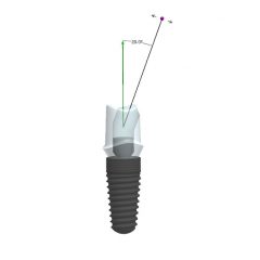 Imagem da notícia: BEGO apresenta canais de parafusos angulados para restaurações de uma só peça com um dente