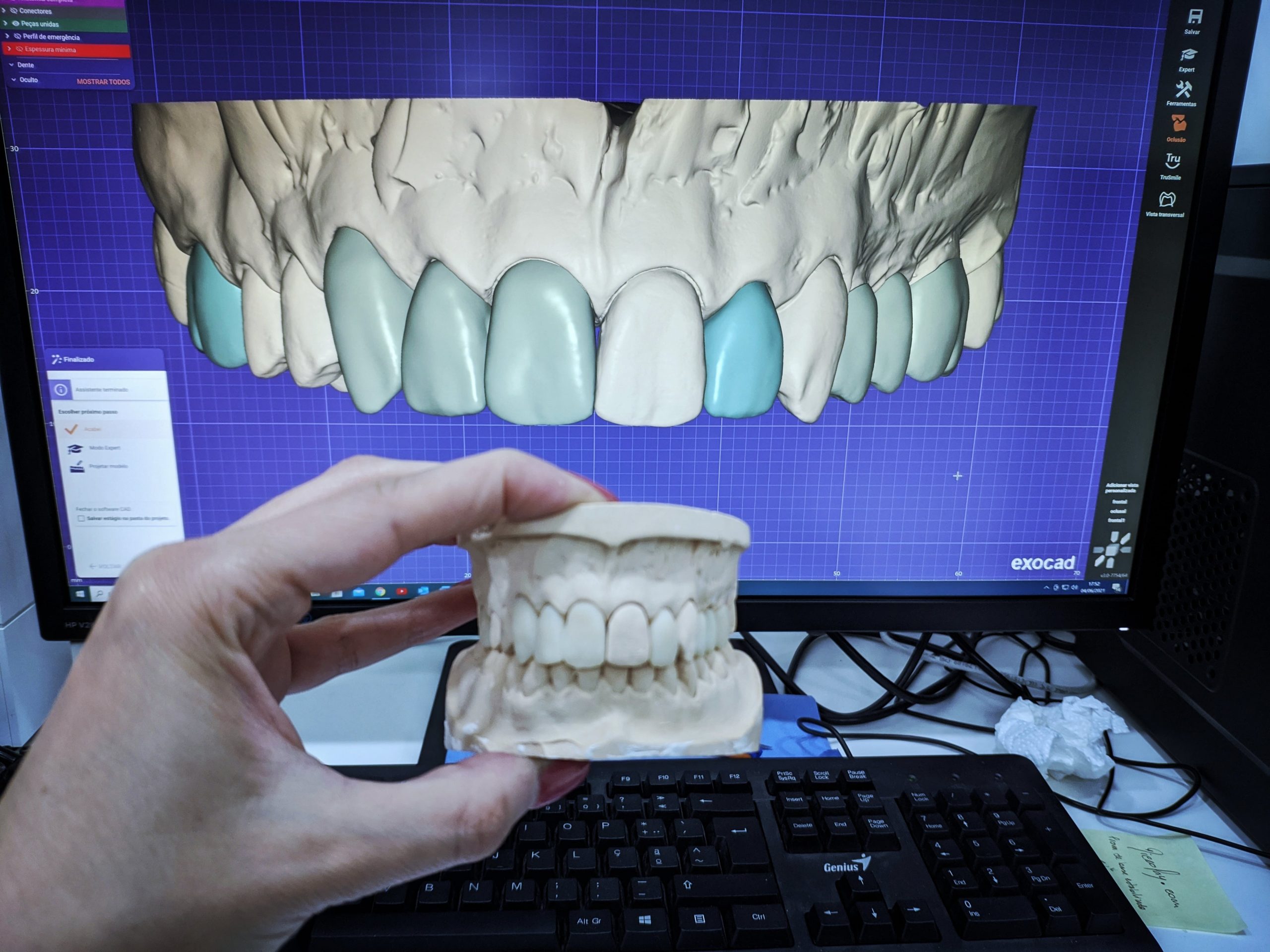 Imagem da notícia: Digital 4.0, uma Era tecnológica nos Laboratórios de Prótese Dentária