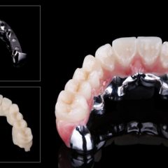 Imagem da notícia: Zirkonzahn revela Bartplatte, a nova barra com desenho específico