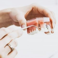 Imagem da notícia: MD Academy organiza curso de gestão de laboratório de prótese dentária