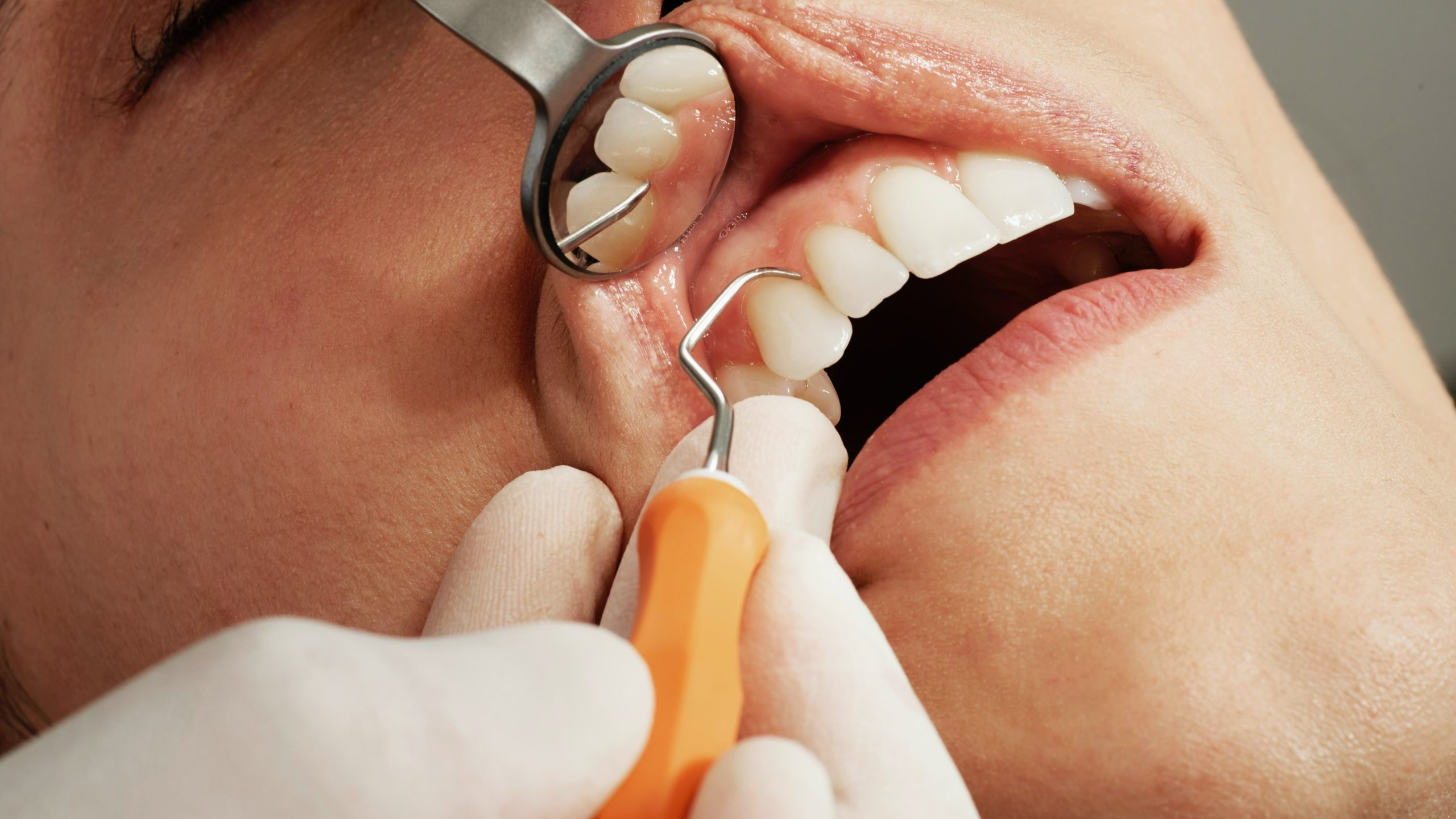 Imagem da notícia: Investigadores desenvolvem teste rápido para doença periodontal