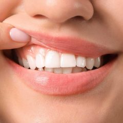 Imagem da notícia: “As gengivas são o máximo! Mantenha-as seguras!” é o lema do Gum Health Day