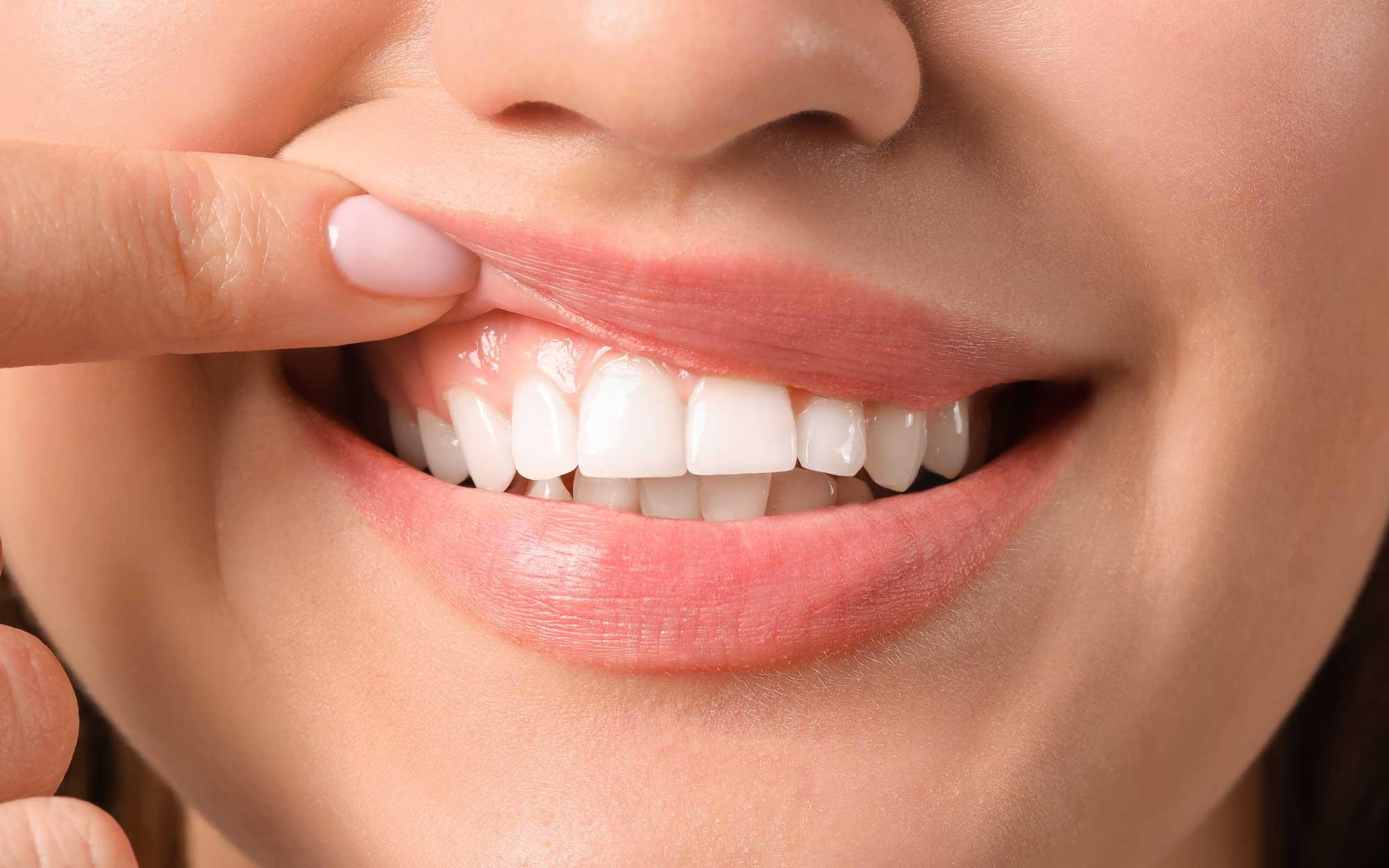 Imagem da notícia: “As gengivas são o máximo! Mantenha-as seguras!” é o lema do Gum Health Day