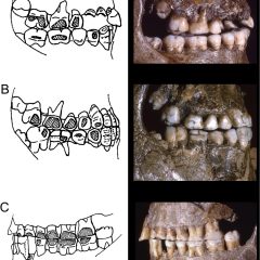 Imagem da notícia: Paleolítico Superior com piercings na cara? Descoberta recente diz que sim