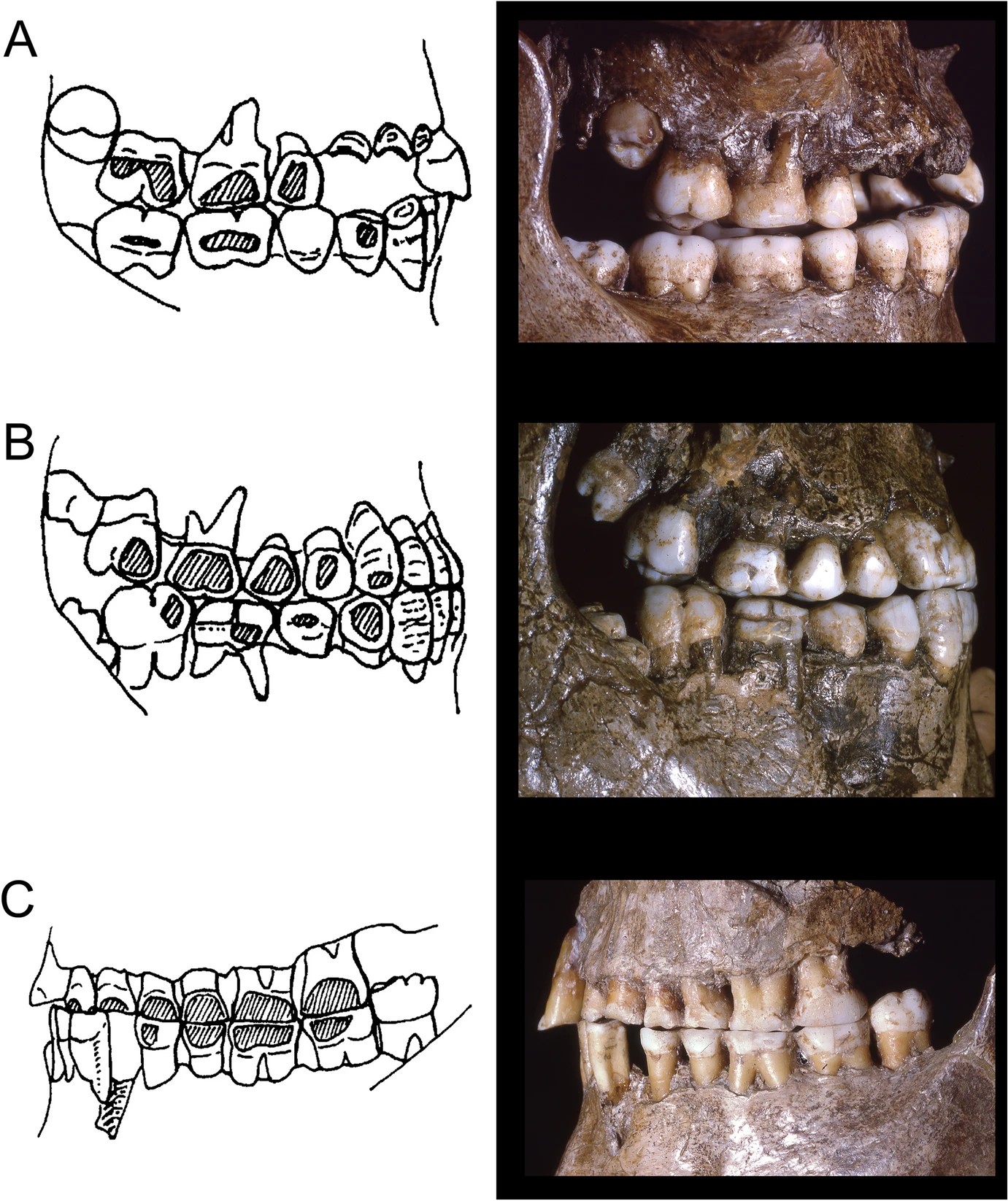 Imagem da notícia: Paleolítico Superior com piercings na cara? Descoberta recente diz que sim