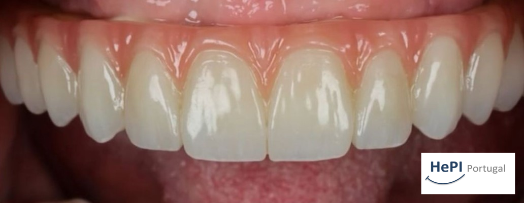 Imagem da notícia: Novos discos de zircónia chegam ao mercado pela HePI Portugal