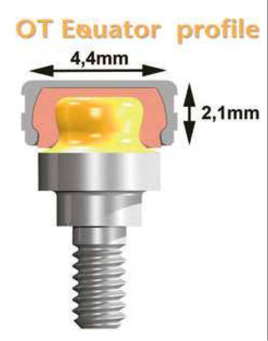 Imagem da notícia: Oclusão e Attachments: O esquema subjacente para sobredentaduras bem-sucedidas