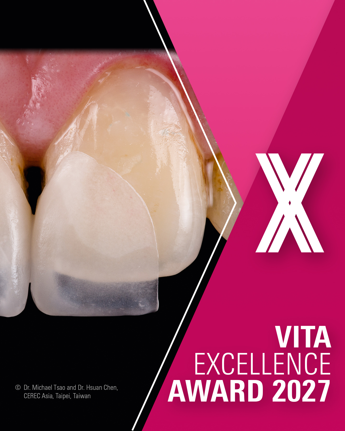 Imagem da notícia: VITA Excellence Award 2027 com inscrições abertas